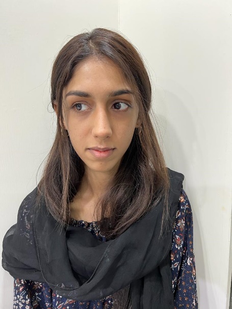 Postoperative frontal photograph following rhinoplasty
